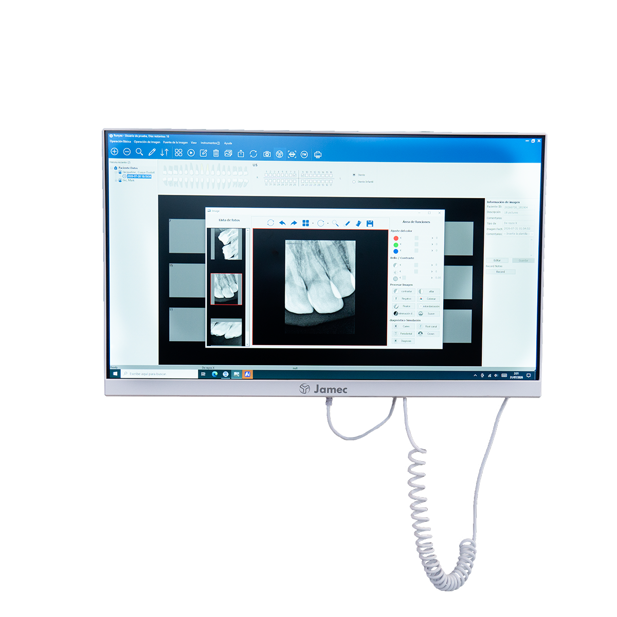 SISTEMA INTRAORAL TODO EN 1 JAMEC