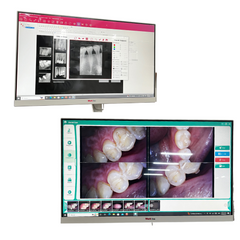 SISTEMA CAMARA INTRAORAL MARK DE 24 MOD LGD-A01